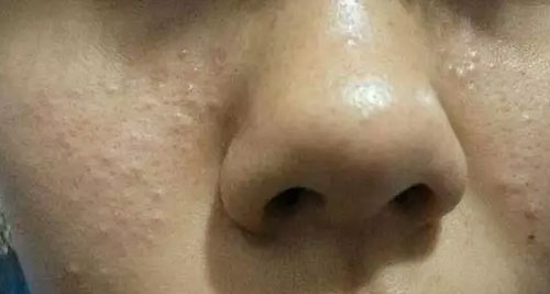 ĤڼҲSPA